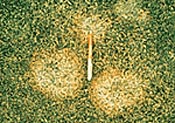 Fusarium